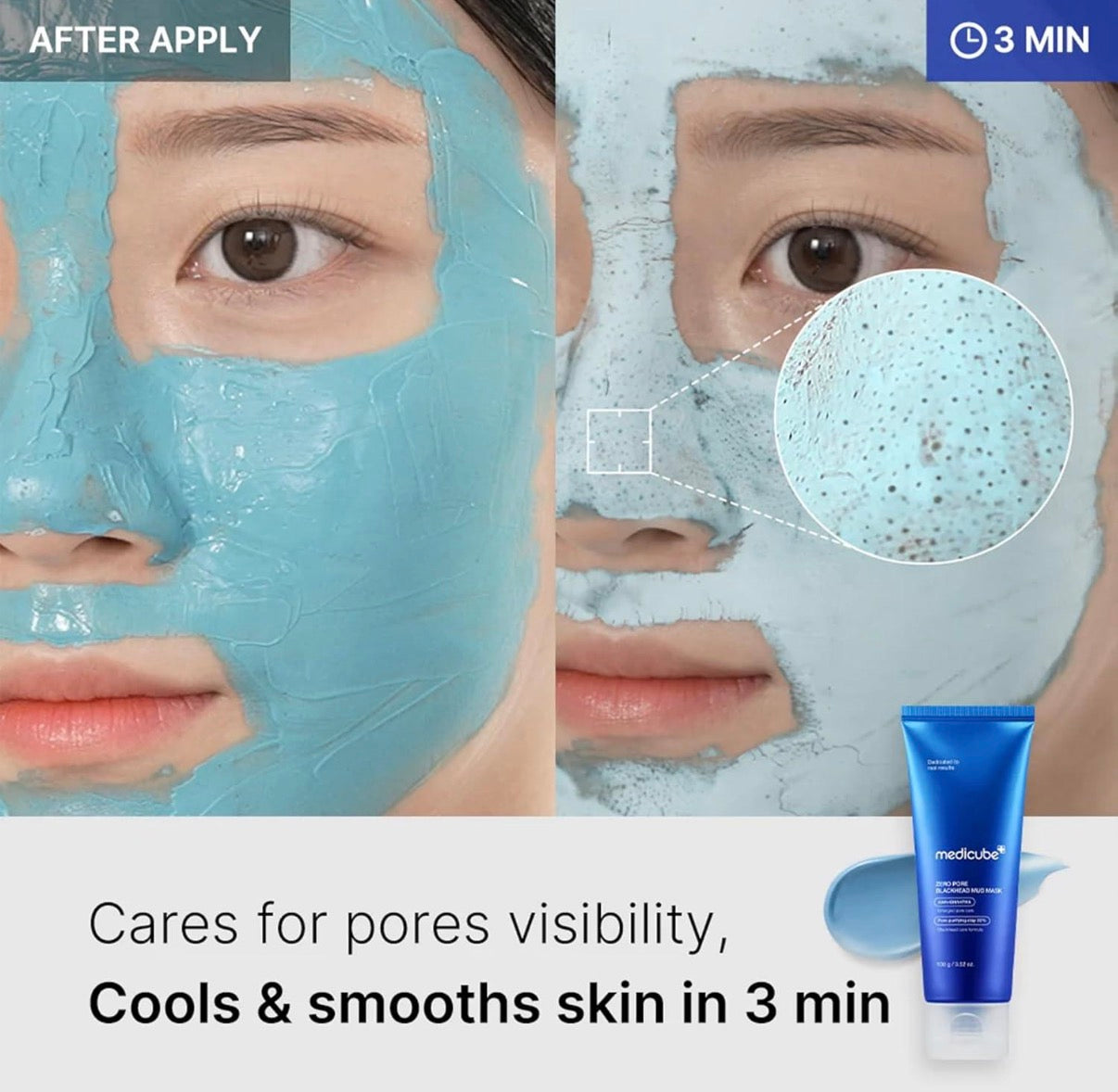 Cube Blackhead Mask